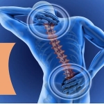 Bel Kayması Ameliyatı Sonrası Yaşam: Kalıcı Çözüm Mümkün mü?