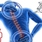 Beyin ve Omurga Cerrahisinde Hasta Profili Değişti: Genç Yaşta Ameliyatlar Artıyor